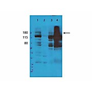 Anti-TET2 (RABBIT) Antibody, 25µL, Liquid (sterile filtered)