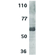 IL-21 Receptor Antibody (near n-t) 100µg