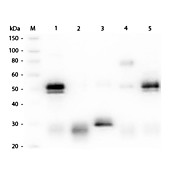 Anti-RABBIT IgG (H&L) (GOAT) Antibody Rhodamine Conjugated (Min X Bv Ch Gt GP Ham Hs Hu Ms Rt & Sh Serum Proteins), 1mg, Lyophilized
