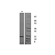 Human Interleukin-21 Recombinant Protein
