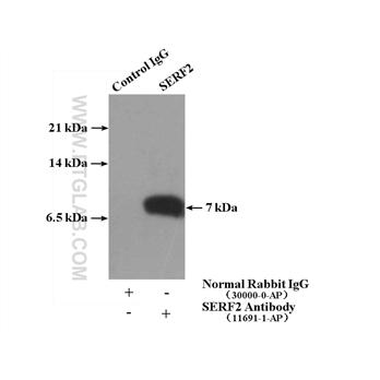 SERF2 Rabbit Polyclonal Antibody (11691-1-AP)
