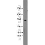 CDCA4 Rabbit Polyclonal Antibody (11625-1-AP)