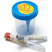 Vacutainer® Urine Collection System