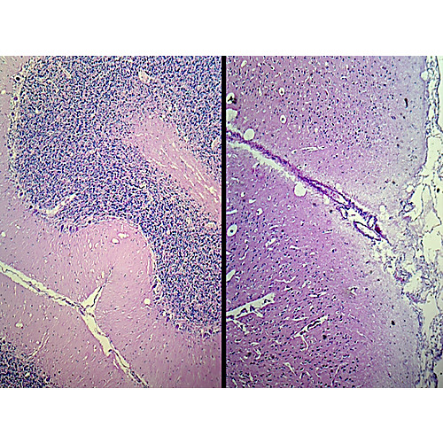 Prepared Microscope Slide,Brain Composite Cerebrum & Cerebellum