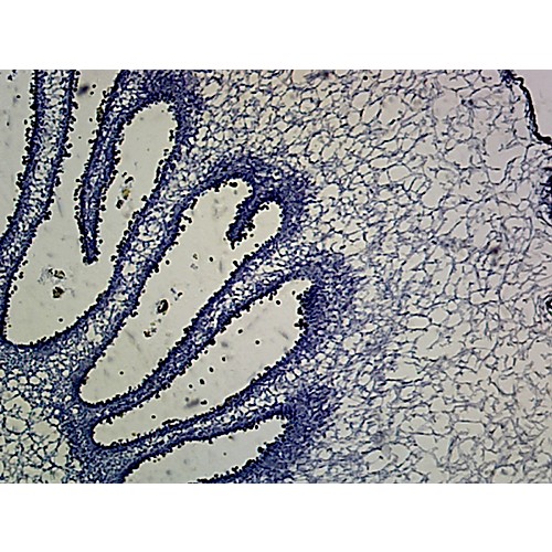 Prepared Microscope Slide,Dimorphic Fungus Pileups Gills Spores