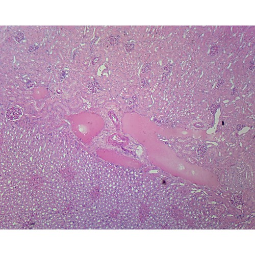 Prepared Microscope Slide,Kidney Section, Human