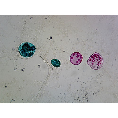 Prepared Microscope Slide,Volvox, Reproduction W.M. Sexual Cells