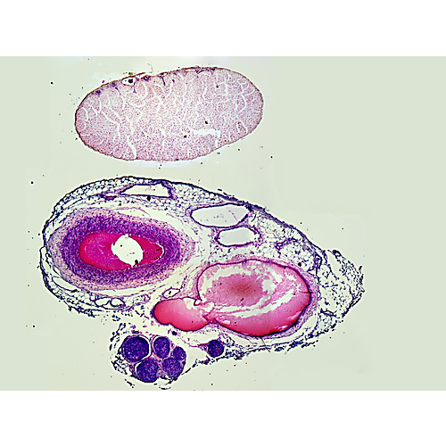 Prepared Microscope Slide Circulatory System Artery Vein Nerve Prepared Microscope Slide Circulatory System Artery Vein Nerve