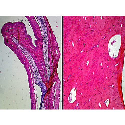 Prepared Microscope Slide,Cartilage & Compact Bone, Decalcified