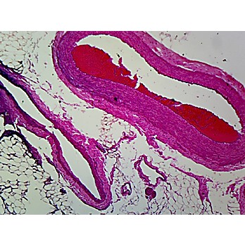 Prepared Microscope Slide Artery Vein Nerve C S Human