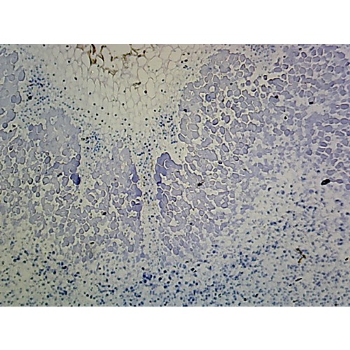 Prepared Microscope Slide,Root Legume, Nitrogen Fixing Bacteria